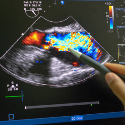 Diploma in Echocardiography